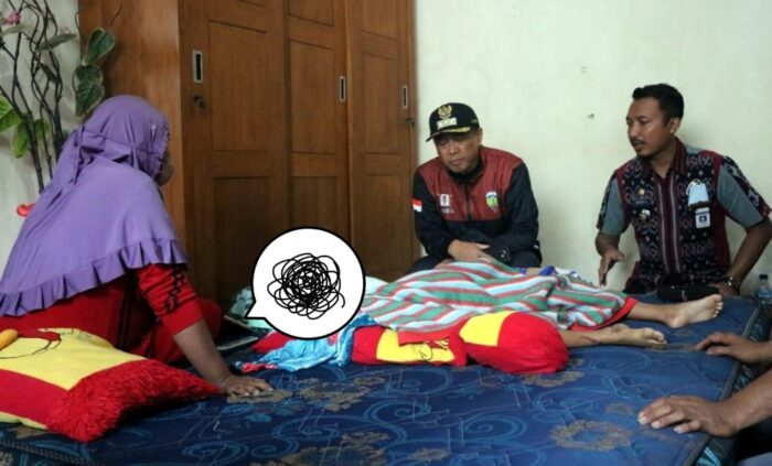 Duh, Seorang Bocah 8 Tahun di Jepara Tubuhnya Terbakar 80 Persen Akibat Bermain Api